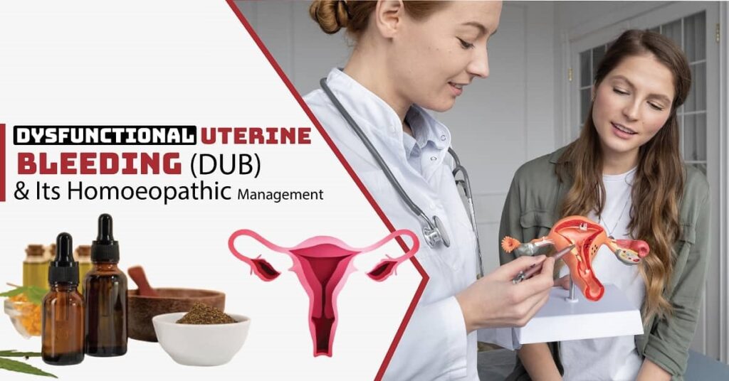 Dysfunctional Uterine Bleeding (DUB) & Its Homoeopathic Management