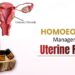 Homoeopathic Management of Uterine Fibroids