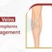 Varicose Veins: Causes, Symptoms, and Management