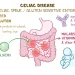 Homeopathic Treatment for Celiac Disease