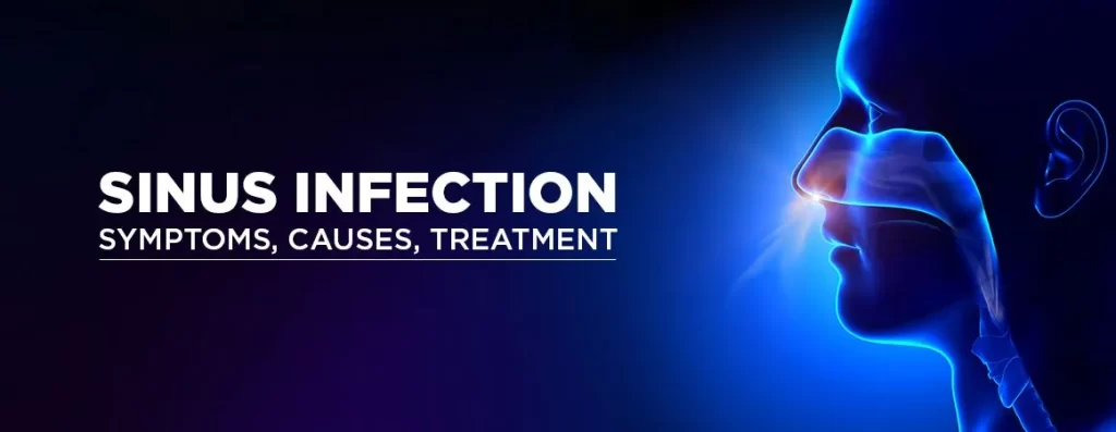 Sinus Infection: Symptoms, Causes, Treatment