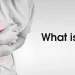 What is Acidity?