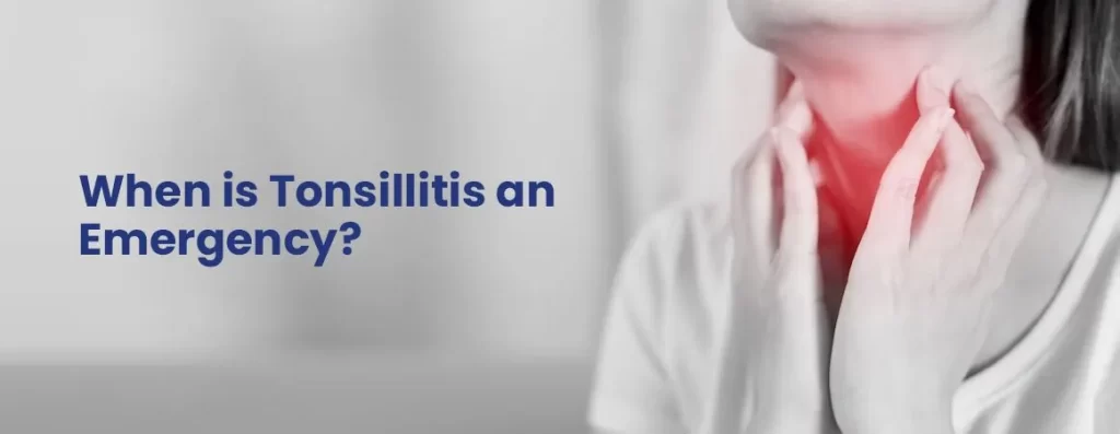 When is Tonsillitis an Emergency?