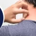 Why Skin Allergy Occurs?